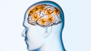 Neurologische Reha
